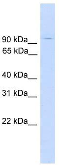 WB Suggested Anti-ZNF224 Antibody Titration: 0.2-1 ug/ml; Positive Control: Human Muscle