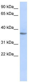 WB Suggested Anti-OR10X1 Antibody Titration: 0.2-1 ug/ml; ELISA Titer: 1:62500; Positive Control: Human Muscle