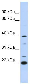 WB Suggested Anti-PEF1 Antibody Titration: 0.2-1 ug/ml; ELISA Titer: 1:1562500; Positive Control: 721_B cell lysatePEF1 is supported by BioGPS gene expression data to be expressed in 721_B