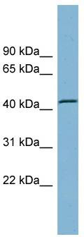 WB Suggested Anti-TBC1D13 Antibody Titration: 0.2-1 ug/ml; ELISA Titer: 1:62500; Positive Control: Human kidney