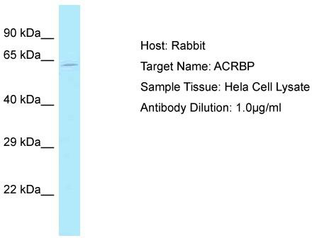Host: Rabbit; Target Name: ACRBP; Sample Tissue: Hela Whole Cell lysates; Antibody Dilution: 1.0 ug/ml