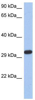 WB Suggested Anti-CAPZA3 Antibody Titration: 0.2-1 ug/ml; ELISA Titer: 1:1562500; Positive Control: DU145 cell lysate