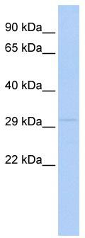 WB Suggested Anti-LYPD4 Antibody Titration: 0.2-1 ug/ml; ELISA Titer: 1:312500; Positive Control: 721_B cell lysate