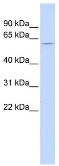 WB Suggested Anti-NT5C1B Antibody Titration: 0.2-1 ug/ml; ELISA Titer: 1:312500; Positive Control: Human Liver