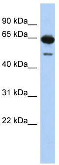 WB Suggested Anti-DAZ1 Antibody Titration: 0.2-1 ug/ml; ELISA Titer: 1:1562500; Positive Control: Jurkat cell lysate