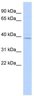 WB Suggested Anti-RP11-217H1.1 Antibody Titration: 0.2-1 ug/ml; ELISA Titer: 1:1562500; Positive Control: Human brain