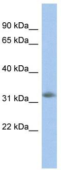 WB Suggested Anti-NGRN Antibody Titration: 0.2-1 ug/ml; ELISA Titer: 1:312500; Positive Control: Jurkat cell lysate
