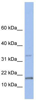 WB Suggested Anti-TCL1A Antibody Titration: 0.2-1 ug/ml; ELISA Titer: 1:1562500; Positive Control: Human brain