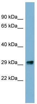 WB Suggested Anti-PRKRIP1 Antibody Titration: 0.2-1 ug/ml; ELISA Titer: 1:1562500; Positive Control: COLO205 cell lysate