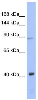 WB Suggested Anti-EIF2C3 Antibody Titration: 0.2-1 ug/ml; ELISA Titer: 1:312500; Positive Control: Human Thymus