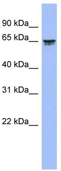 WB Suggested Anti-LZTS2 Antibody Titration: 0.2-1 ug/ml; ELISA Titer: 1:62500; Positive Control: Human Spleen