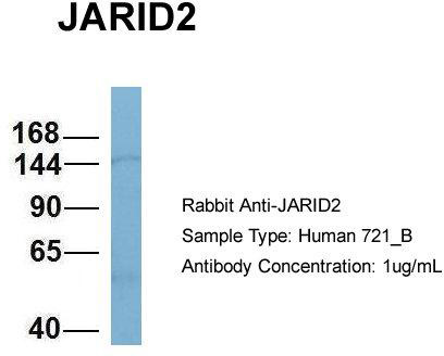 Host: Rabbit; Target Name: JARID2; Sample Tissue: 721_B; Antibody Dilution: 1.0 ug/ml. JARID2 is strongly supported by BioGPS gene expression data to be expressed in Human 721_B cells
