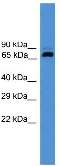 WB Suggested Anti-USP2 Antibody Titration: 0.2-1 ug/ml; ELISA Titer: 1:312500; Positive Control: Human brain