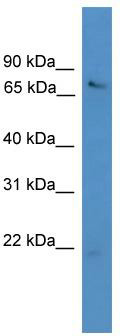 WB Suggested Anti-USP2 Antibody Titration: 0.2-1 ug/ml; ELISA Titer: 1:312500; Positive Control: HCT15 cell lysate