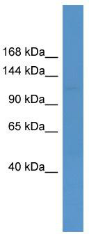 WB Suggested Anti-USP26 Antibody Titration: 0.2-1 ug/ml; ELISA Titer: 1:1562500; Positive Control: Human kidney