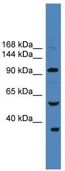 WB Suggested Anti-USP29 Antibody Titration: 0.2-1 ug/ml; ELISA Titer: 1:1562500; Positive Control: 293T cell lysate