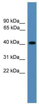 WB Suggested Anti-AIMP2 Antibody Titration: 0.2-1 ug/ml; ELISA Titer: 1:1562500; Positive Control: HepG2 cell lysate AIMP2 is strongly supported by BioGPS gene expression data to be expressed in Human HepG2 cells