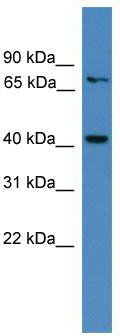 WB Suggested Anti-AIMP2 Antibody Titration: 0.2-1 ug/ml; ELISA Titer: 1:1562500; Positive Control: MCF7 cell lysateAIMP2 is strongly supported by BioGPS gene expression data to be expressed in Human MCF7 cells