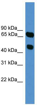 WB Suggested Anti-SYT16 Antibody Titration: 0.2-1 ug/ml; ELISA Titer: 1:312500; Positive Control: HepG2 cell lysate