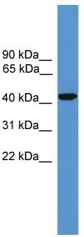 WB Suggested Anti-SYT5 Antibody Titration: 1 ug/ml; Positive Control: Fetal kidney lysate