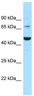 Host: Rabbit; Target Name: SLC6A11; Sample Tissue: PANC1 Whole Cell lysates; Antibody Dilution: 1.0 ug/ml