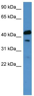 WB Suggested Anti-CALCR Antibody Titration: 0.2-1 ug/ml; ELISA Titer: 1:1562500; Positive Control: Human kidney