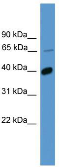 WB Suggested Anti-OR2B2 Antibody; Titration: 1.0 ug/ml; Positive Control: Hela Whole Cell