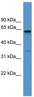 WB Suggested Anti-OR2C1 Antibody; Titration: 1.0 ug/ml; Positive Control: 721_B Whole Cell OR2C1 is supported by BioGPS gene expression data to be expressed in 721_B