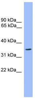 WB Suggested Anti-OR2C3 Antibody; Titration: 1.0 ug/ml; Positive Control: 721_B Whole Cell