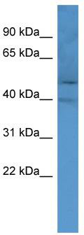 WB Suggested Anti-OR2M2 Antibody Titration: 0.2-1 ug/ml; ELISA Titer: 1:62500; Positive Control: MCF7 cell lysate
