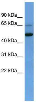 WB Suggested Anti-IQCB1 Antibody Titration: 0.2-1 ug/ml; ELISA Titer: 1:62500; Positive Control: Human heart