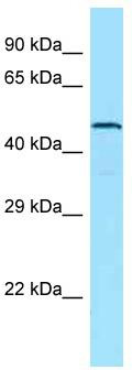 Host: Rabbit; Target Name: GPR123; Sample Tissue: PANC1 Whole Cell lysates; Antibody Dilution: 1.0 ug/ml