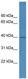 WB Suggested Anti-PHYHIPL Antibody Titration: 0.2-1 ug/ml; ELISA Titer: 1:62500; Positive Control: Hela cell lysate