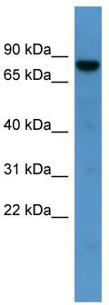 WB Suggested Anti-DNAJC2 Antibody Titration: 0.2-1 ug/ml; ELISA Titer: 1:62500; Positive Control: Human Liver
