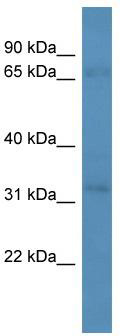 Gel: 6%SDS-PAGE<br>Lysate: 40 μg<br>Lane: A172 cell lysate<br>Primary antibody: TA372204 (CDC42BPA Antibody) at dilution 1/600<br>Secondary antibody: Goat anti rabbit IgG at 1/8000 dilution<br>Exposure time: 5 minutes