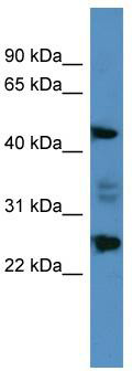WB Suggested Anti-OSGIN2 Antibody Titration: 0.2-1 ug/ml; ELISA Titer: 1:62500; Positive Control: HepG2 cell lysate