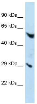 Host: Rabbit; Target Name: EMR3; Sample Tissue: HepG2 Whole Cell lysates; Antibody Dilution: 1.0 ug/ml