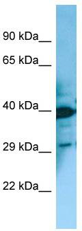 WB Suggested Anti-MCHR2 Antibody; Titration: 1.0 ug/ml; Positive Control: Fetal Bladder