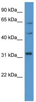 WB Suggested Anti-MKNK1 Antibody Titration: 0.2-1 ug/ml; ELISA Titer: 1:312500; Positive Control: 293T cell lysate MKNK1 is supported by BioGPS gene expression data to be expressed in HEK293T