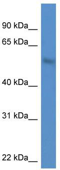 WB Suggested Anti-MKNK1 Antibody; Titration: 1.0 ug/ml; Positive Control: A549 Whole Cell MKNK1 is supported by BioGPS gene expression data to be expressed in A549