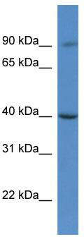 WB Suggested Anti-C9orf64 Antibody; Titration: 1.0 ug/ml; Positive Control: Hela Whole Cell