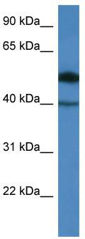 WB Suggested Anti-C9orf64 Antibody; Titration: 1.0 ug/ml; Positive Control: COLO205 Whole Cell