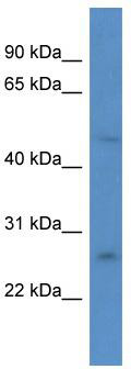 WB Suggested Anti-ANKRD32 Antibody; Titration: 1.0 ug/ml; Positive Control: Jurkat Whole Cell