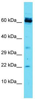 Host: Rabbit; Target Name: CCDC115; Sample Tissue: Jurkat Whole Cell lysates; Antibody Dilution: 1.0 ug/ml