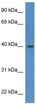 WB Suggested Anti-ELMOD3 Antibody Titration: 0.2-1 ug/ml; ELISA Titer: 1:312500; Positive Control: Human Lung
