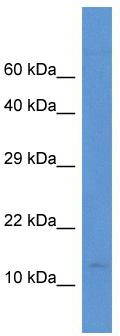 WB Suggested Anti-PCBD2 Antibody; Titration: 1.0 ug/ml; Positive Control: Fetal Small Intestine