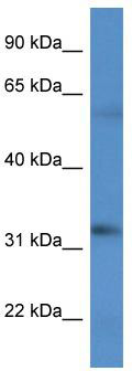 WB Suggested Anti-BCO2 Antibody; Titration: 1.0 ug/ml; Positive Control: HT1080 Whole Cell
