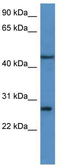 WB Suggested Anti-FGFBP2 Antibody Titration: 0.2-1 ug/ml; ELISA Titer: 1:312500; Positive Control: Hela cell lysate