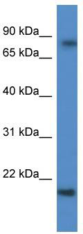 WB Suggested Anti-KRTAP1-5 Antibody; Titration: 1.0 ug/ml; Positive Control: Fetal Brain