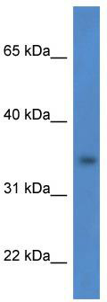 Gel: 6%SDS-PAGE<br>Lysate: 40 μg<br>Lane: PC-3 cell lysate<br>Primary antibody: TA372447 (DZIP1 Antibody) at dilution 1/200<br>Secondary antibody: Goat anti rabbit IgG at 1/8000 dilution<br>Exposure time: 5 minutes
